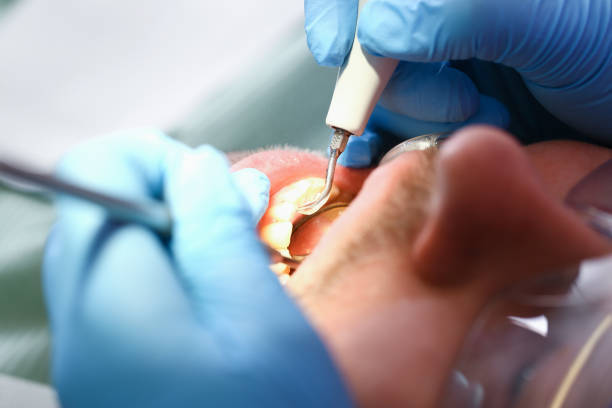 Best Emergency Denture Repair in Gardnerville, NV